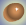 Skin Color